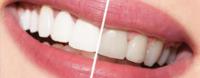 Brantly Dental image 9